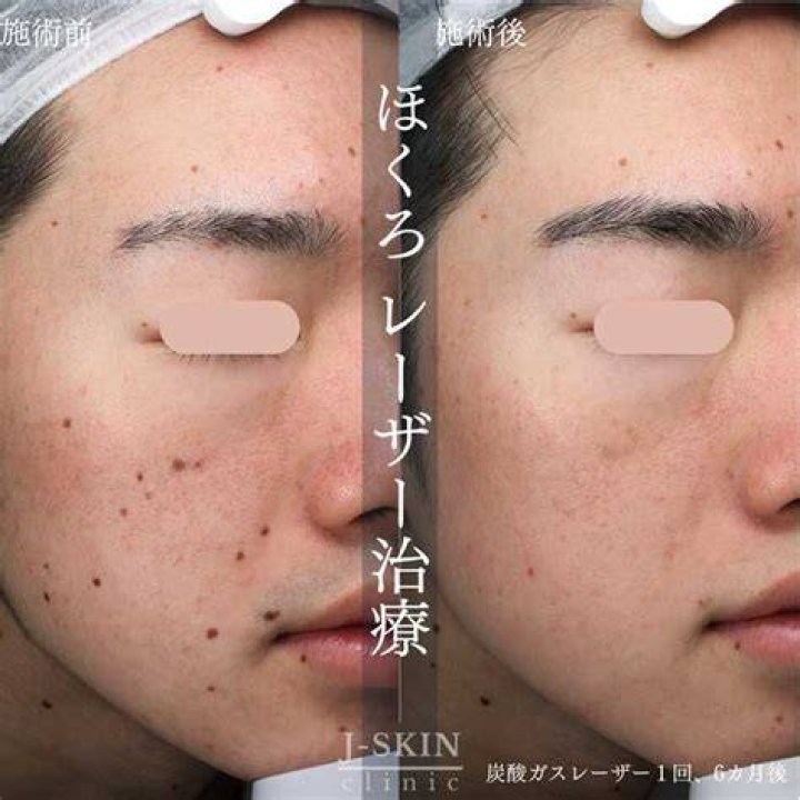 顔のほくろが多い芸能人の印象が生まれる要素を考える